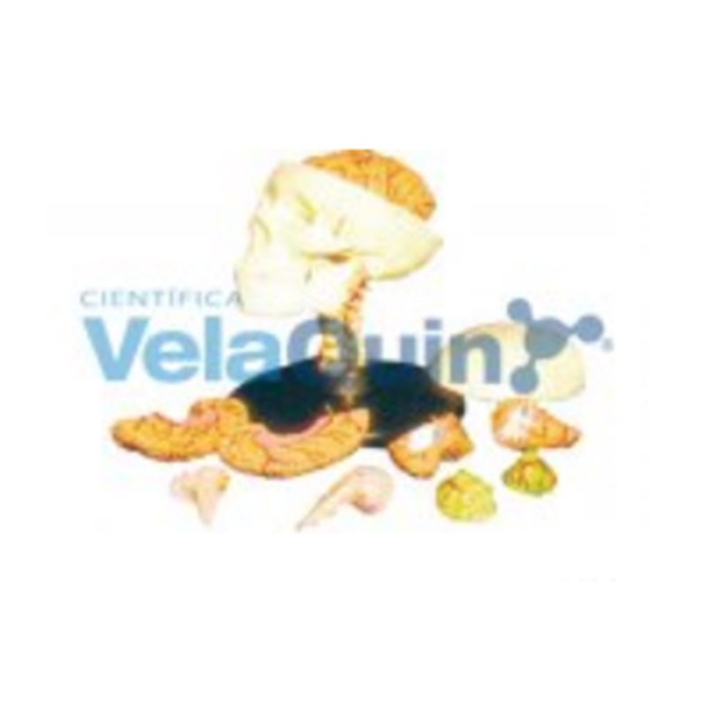 MODELO DE CRANEO CON DIVISION EN 8 PIEZAS